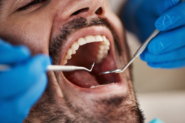 Best Tooth Infection Emergency Dentist  in Carver, MN