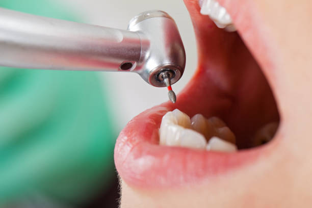 Tooth Infection Emergency Dentist in MN